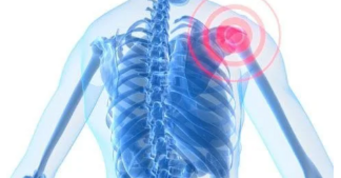 Shoulder Injury from Auto Accident