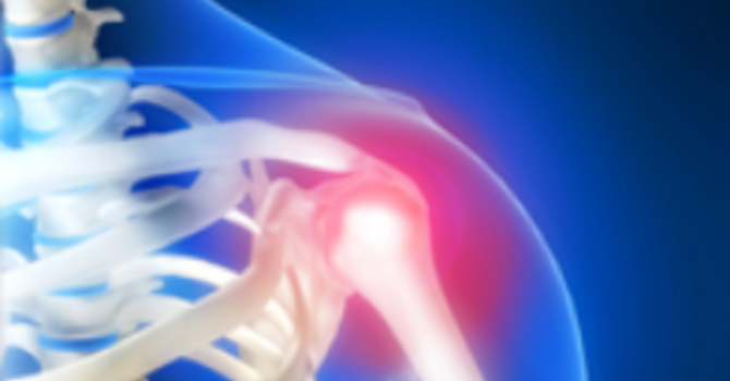 Shoulder Pain